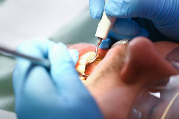 Best Same-Day Emergency Dentist in Lexington, OH