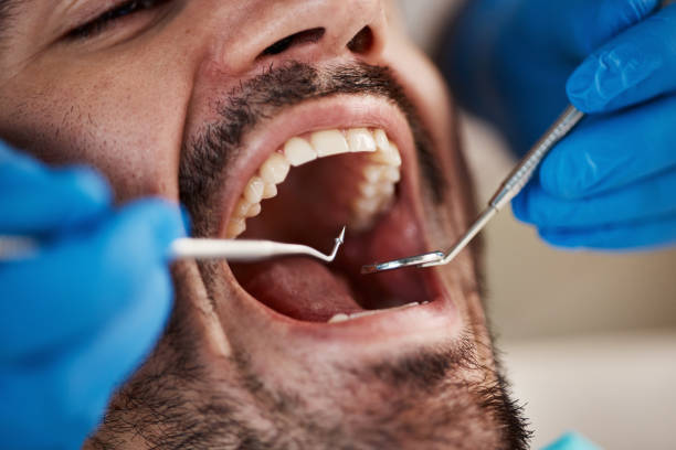 Best After-Hours Emergency Dentist in Lexington, OH